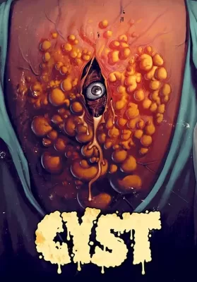 Cyst (2020) ดูหนังออนไลน์ HD
